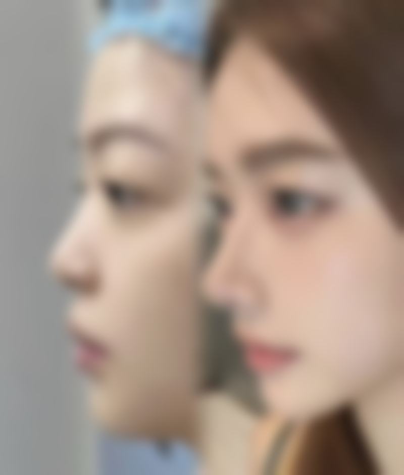 凉山爱丽诺医疗美容门诊部擅长项目