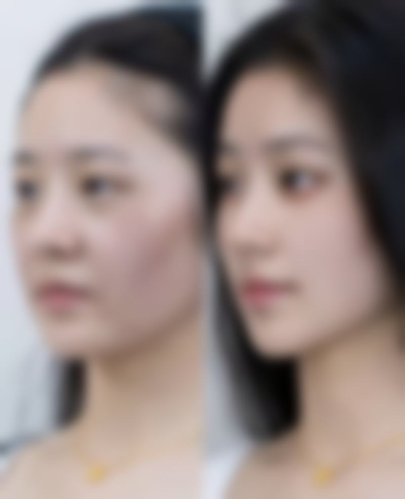 揭阳禾美整形医院地理位置便于到院。