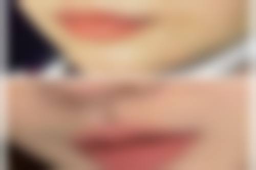 Dacapo牙科治疗反馈与口碑评价。