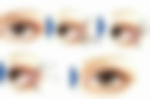 衡水瑞美医疗美容医院擅长项目。