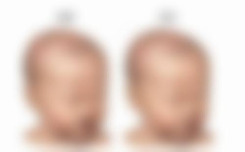 丹阳市人民医院整形外科擅长项目。