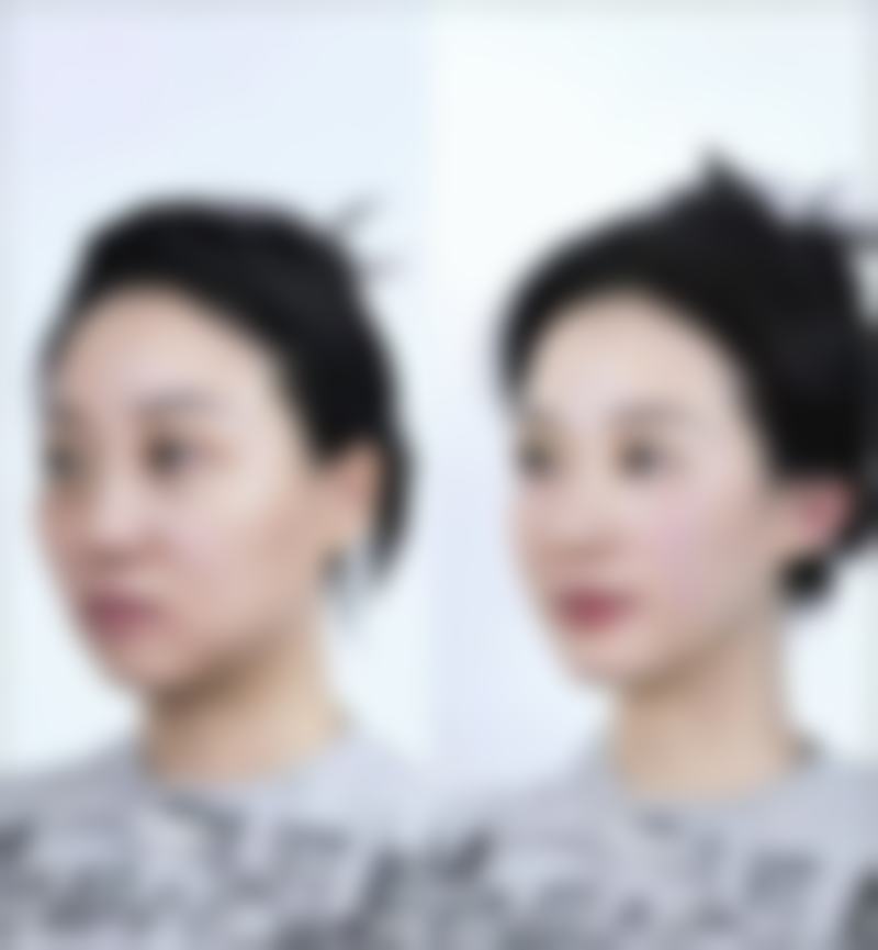无锡市中医医院医疗美容科擅长项目。