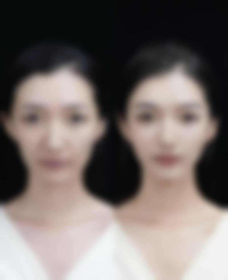 姜昱瑾医生的技术实力