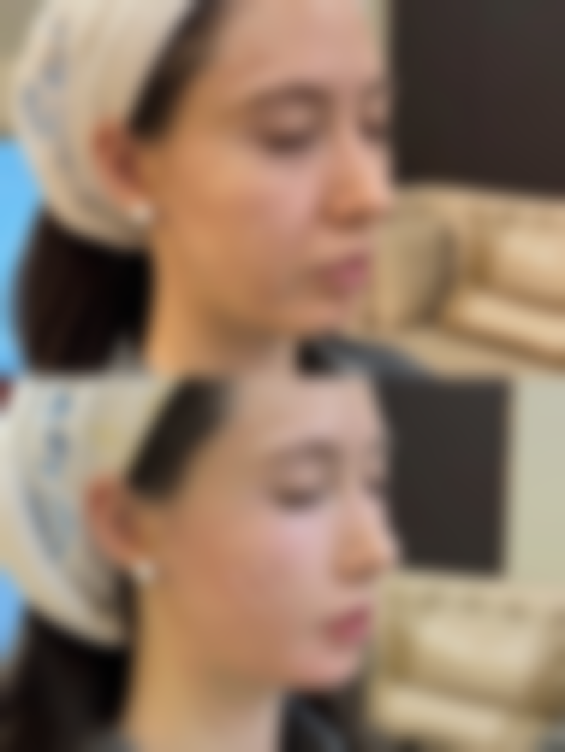 郝昭华医生的擅长项目