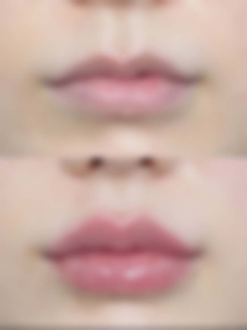 海口美姿整形医院收费价格表