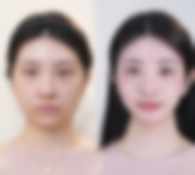 衡水瑞美医疗美容医院2026年价格收费表：