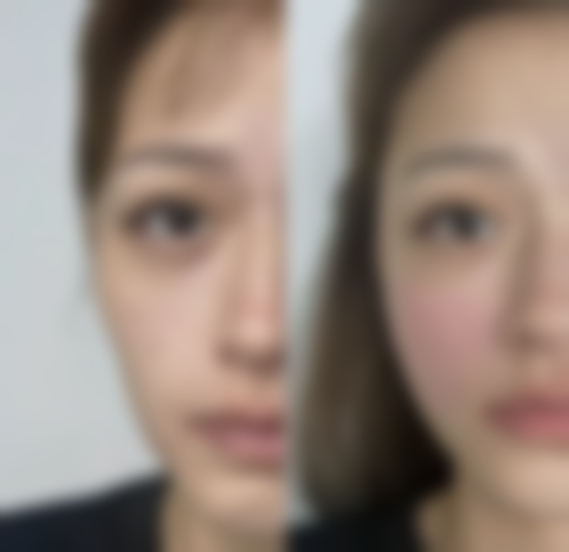 兰州时光激光整形医院(西北旗舰总院)项目价格说明