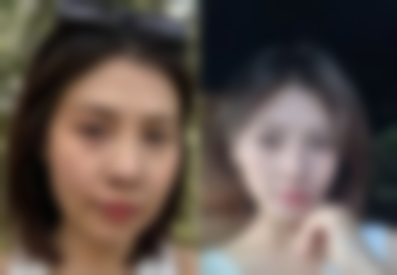 重庆五洲整形美容医院擅长项目