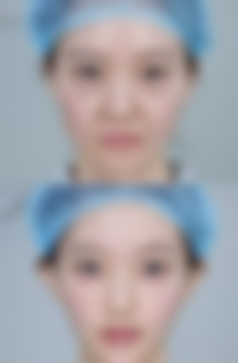 杭州肤康皮肤病医院口碑评价与项目分享