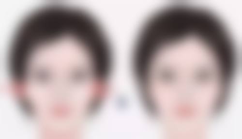 成都高新圣尼莎整形医院治疗反馈与口碑评价。