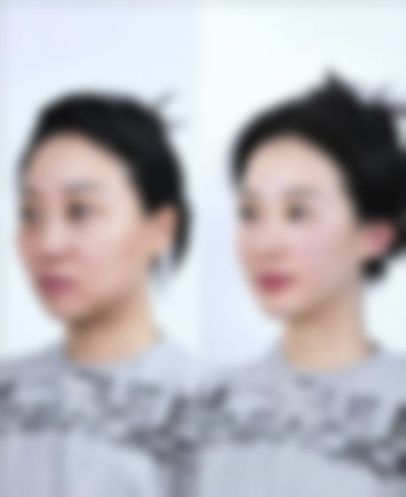 沈阳新秀丽医疗美容门诊部任高飞医生擅长项目