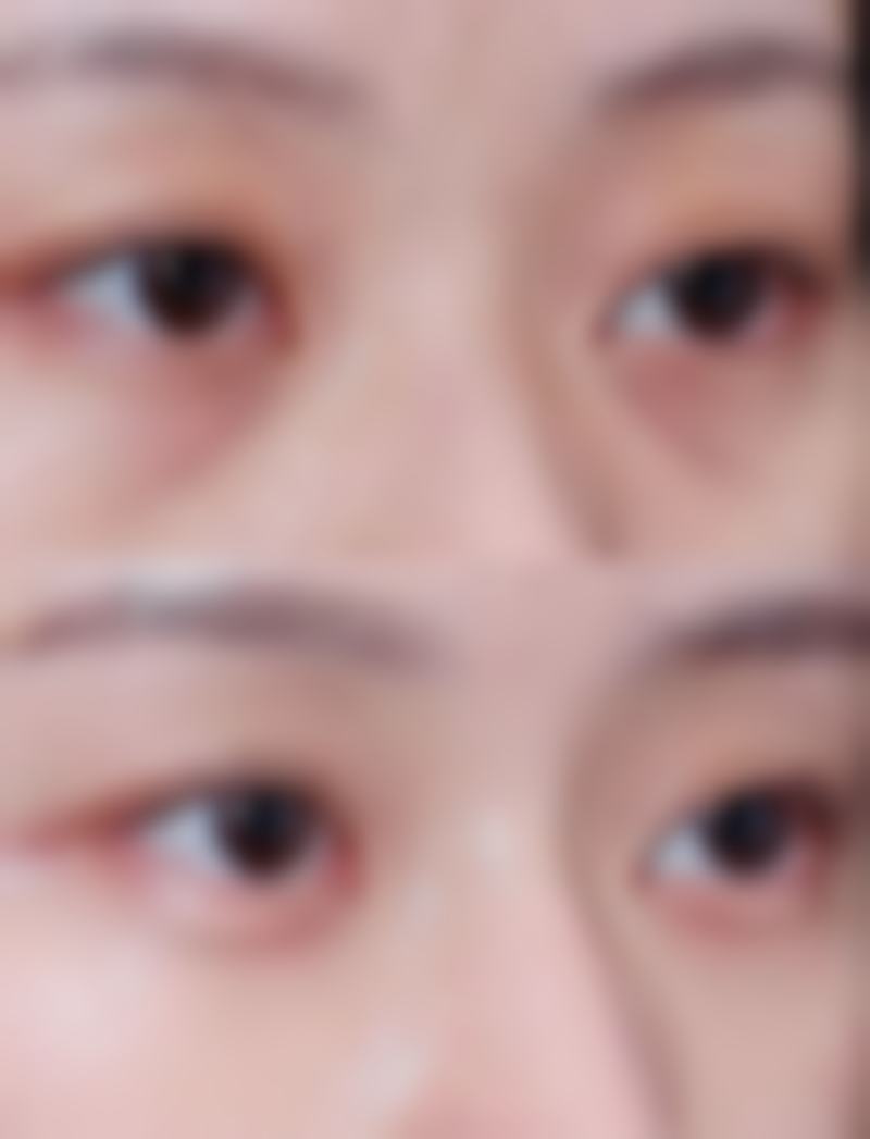 杭州耀然医疗美容诊所擅长项目