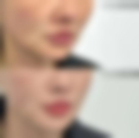 秦皇岛医院整形美容科治疗反馈与口碑评价。