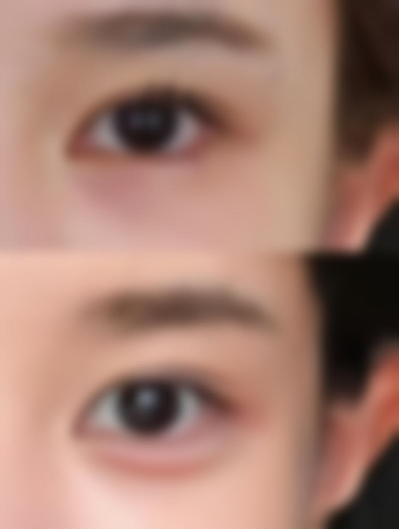 罗光灿擅长的治疗项目