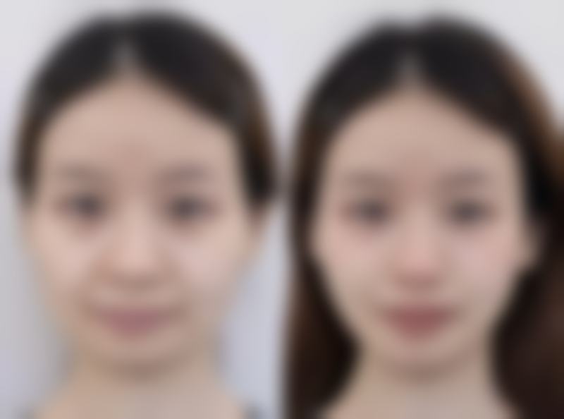 南宁悦星贞韩美容整形医院门诊营业时间。