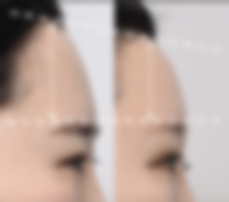 武汉水母整形医院擅长项目