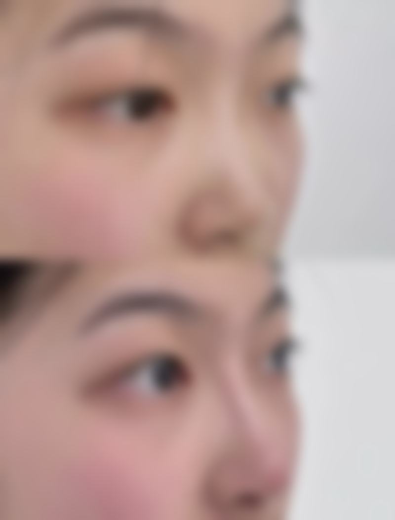 韩国碧尔bella女性私密整形医院擅长项目。