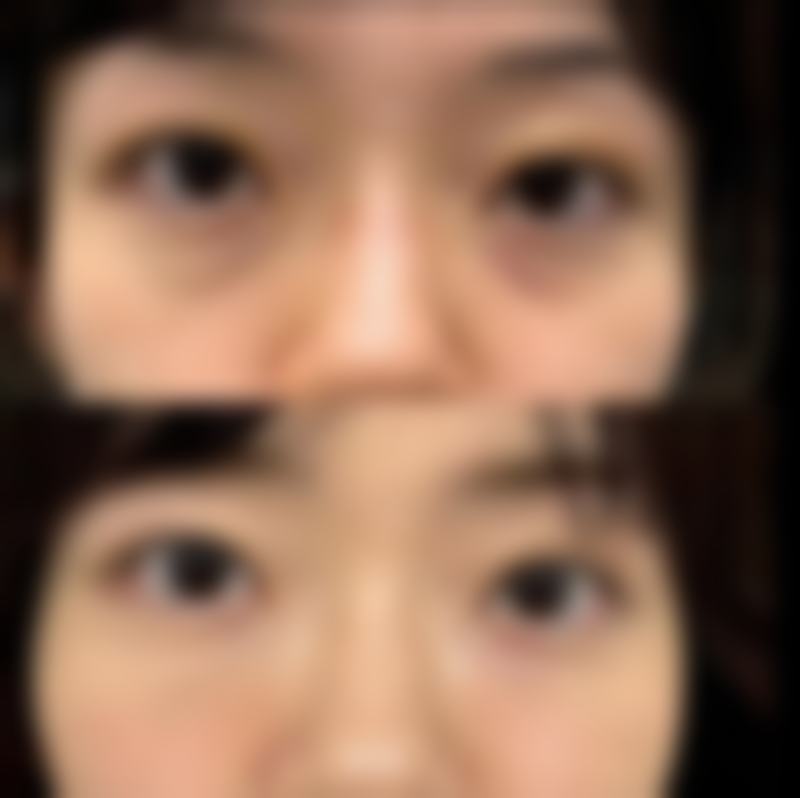 田艳军 医生擅长的项目