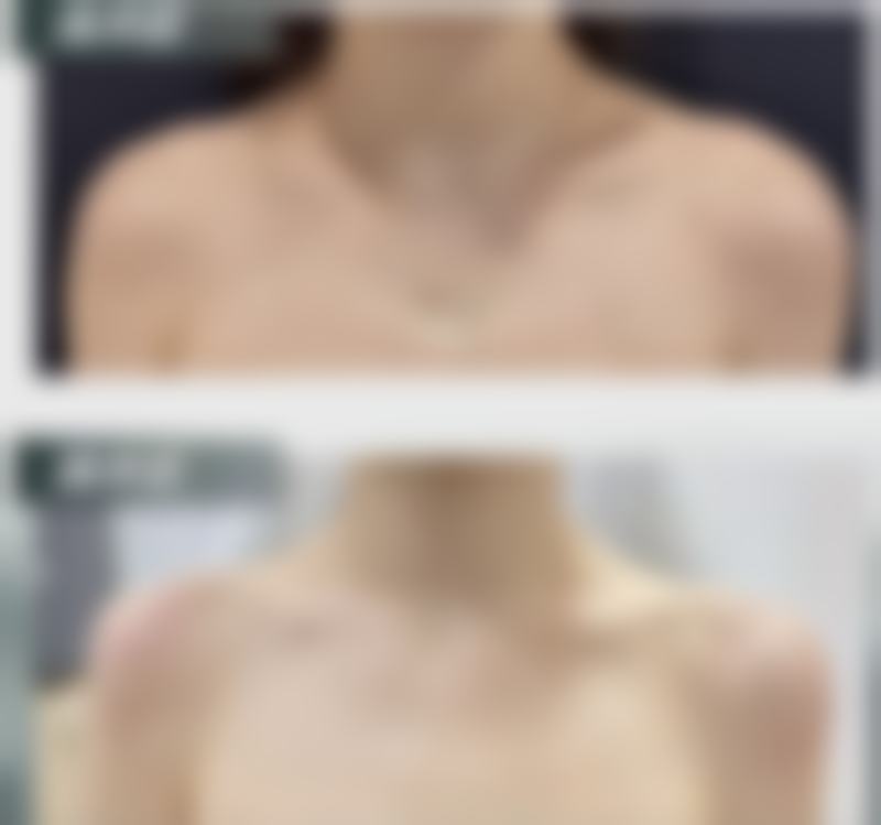 菏泽奥美丽亚医疗美容诊所治疗反馈与口碑评价。