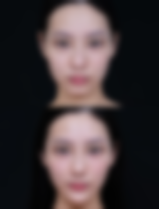 东阳玥莱美医疗美容诊所2026年价格收费表：