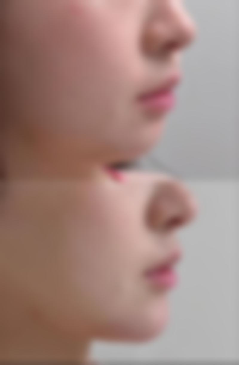 东阳玥莱美医疗美容诊所项目优势明显。