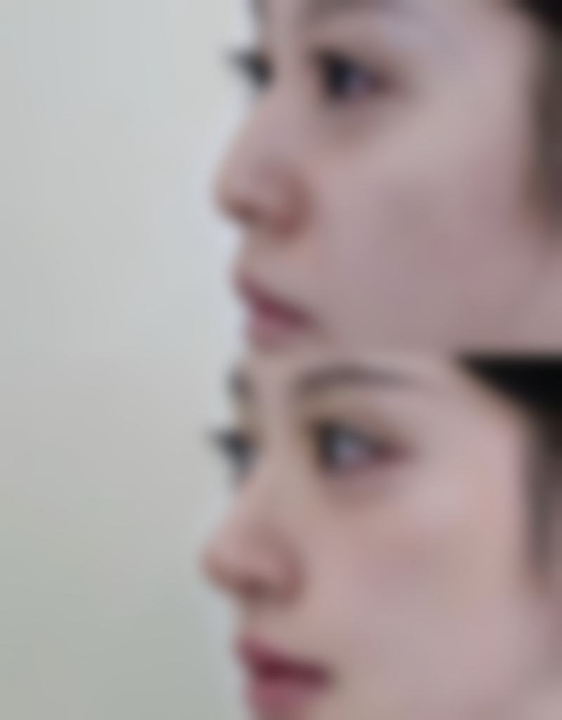 上海奉浦医院整形美容科治疗反馈与口碑评价。