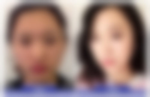韩国111整形外科医院