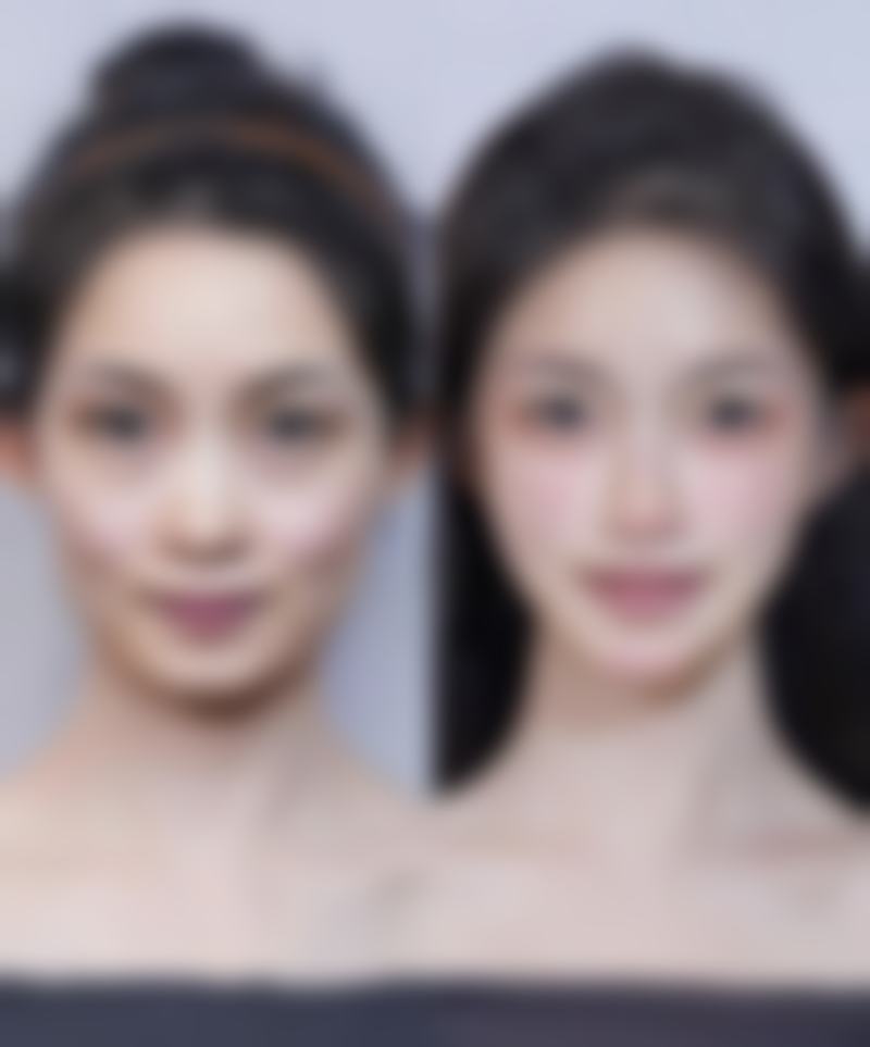 无锡菲尚医疗美容门诊部治疗反馈与口碑评价。