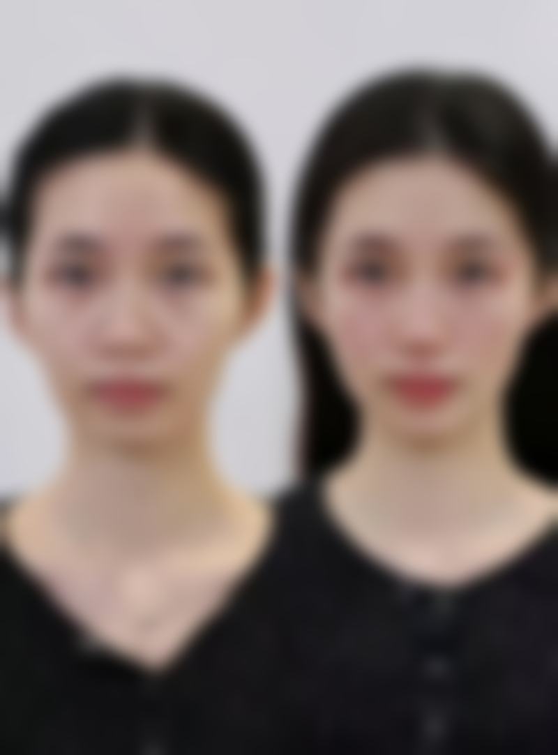 广州美咖整形医院林丰医生上班时间:每天上午九点-下午六点