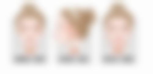 NANA整形外科治疗反馈与口碑评价。