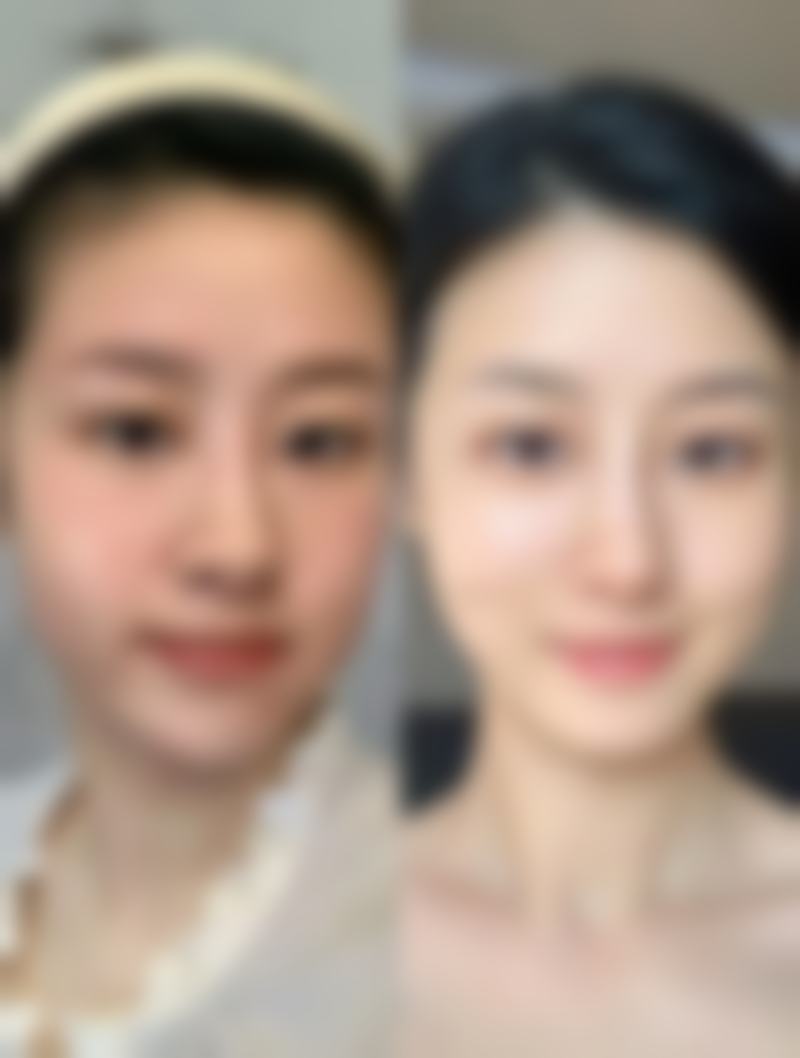 韩国吴世元整形外科医院收费价格表