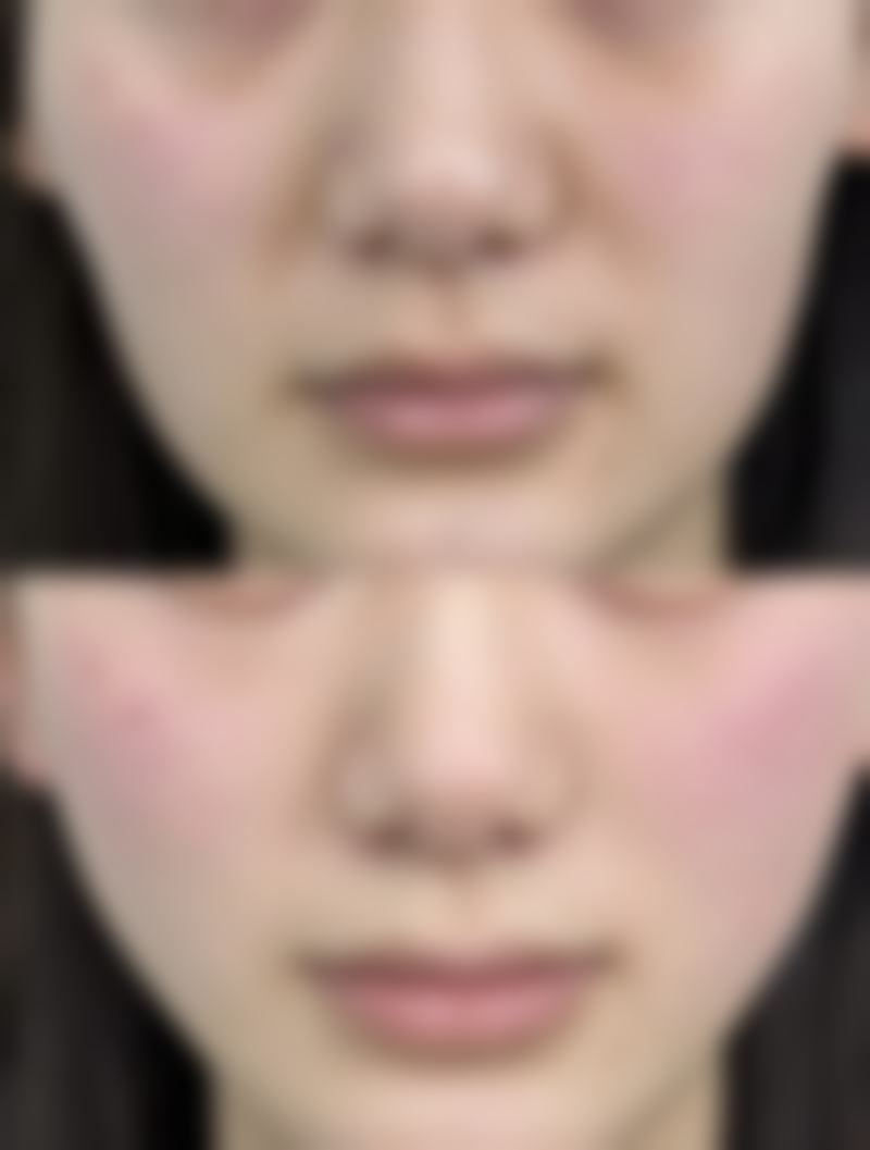 新乡魏作明医疗美容诊所擅长项目