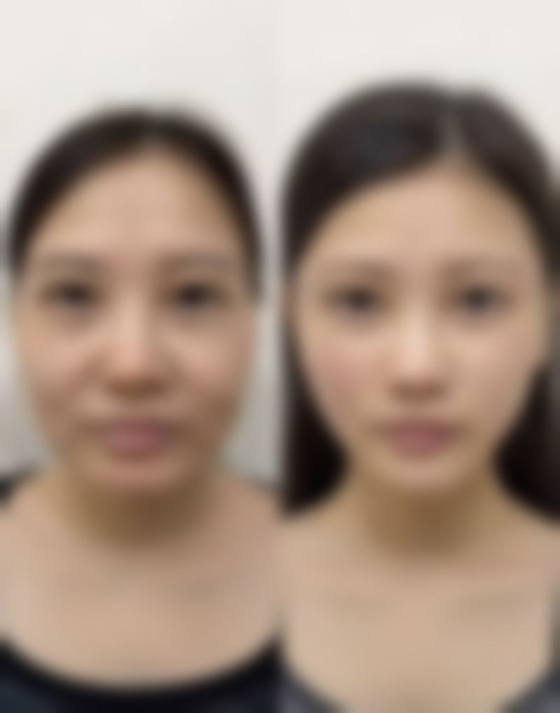 王翠梅医生擅长的项目