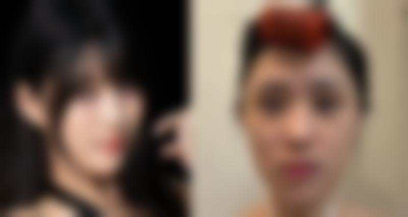 武汉美丽力量整形医院黄美丽医生口碑评价与项目分享: