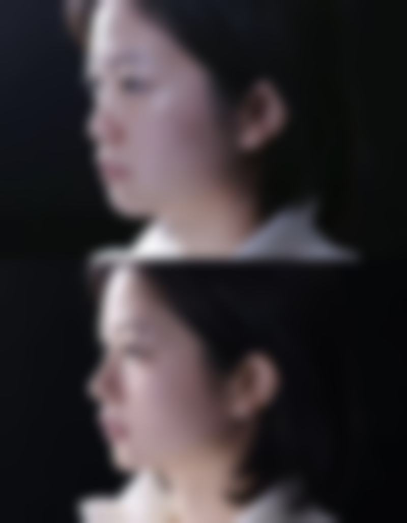 靳方方医生擅长项目