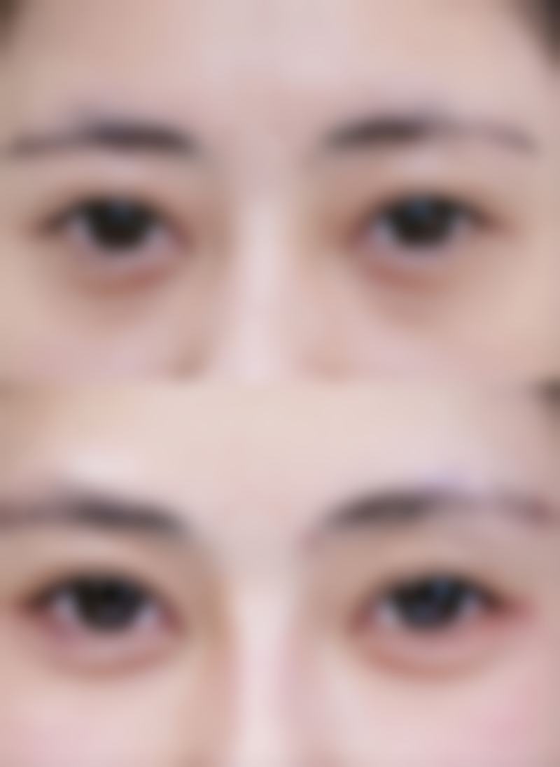 太原巴诺巴奇整形医院擅长项目有哪些?
