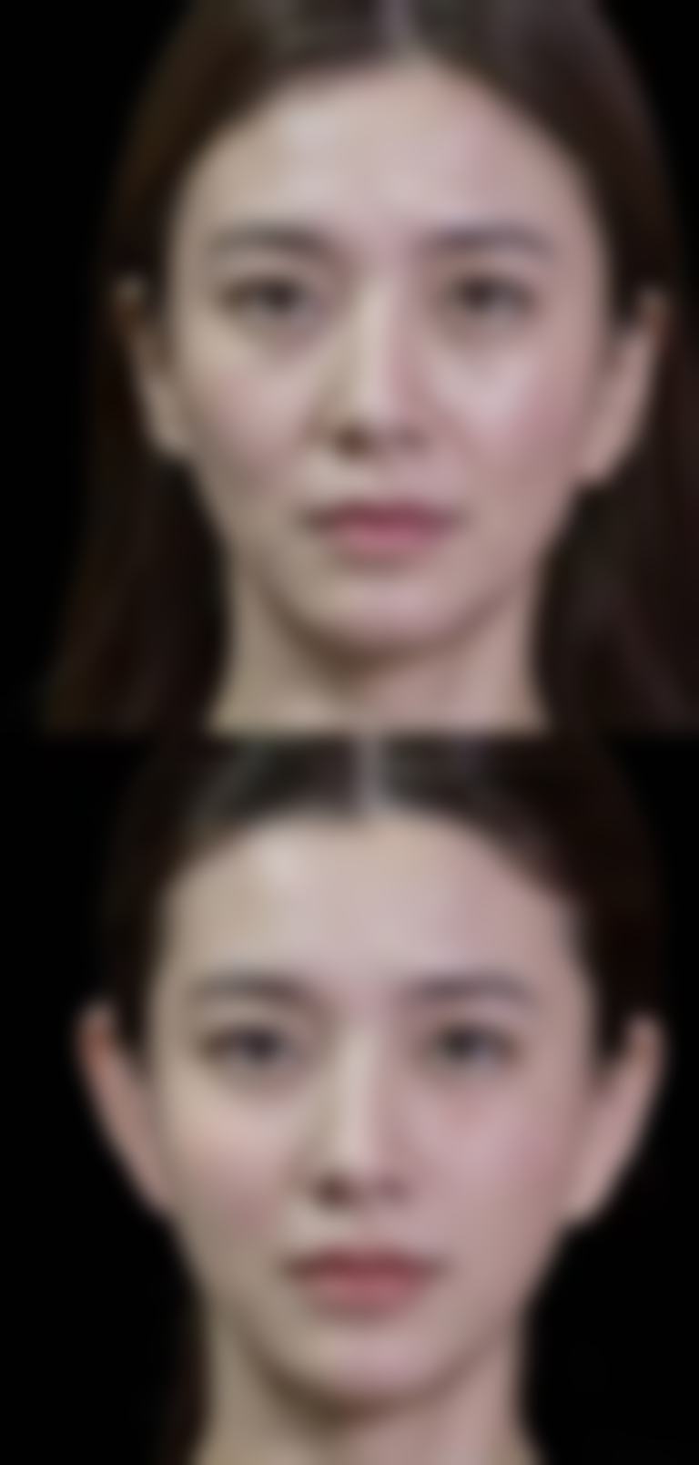 济宁市第二人民医院整形美容科医生团队经验稳定。
