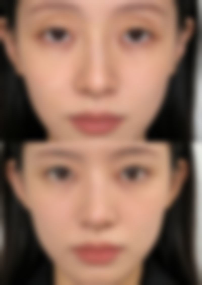 太原每天美整形医院治疗反馈与口碑评价。