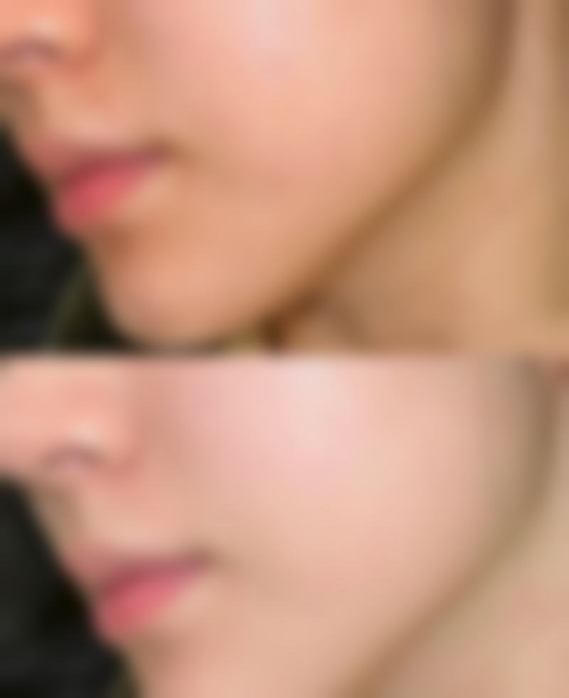 惠州轻雅医疗美容诊所擅长项目。