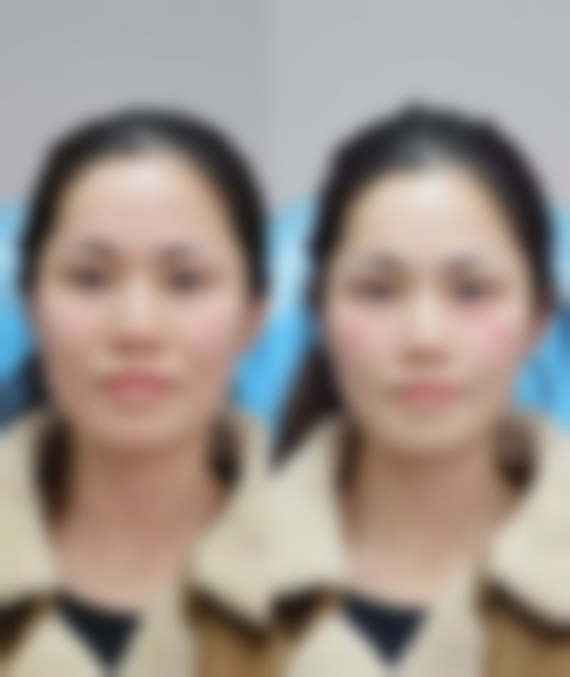 沈阳新秀丽医疗美容门诊部胡永安医生上班时间:每天上午九点 - 下午六点
