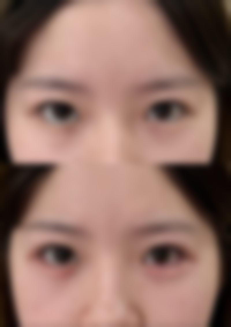 余成艳医生技术怎么样