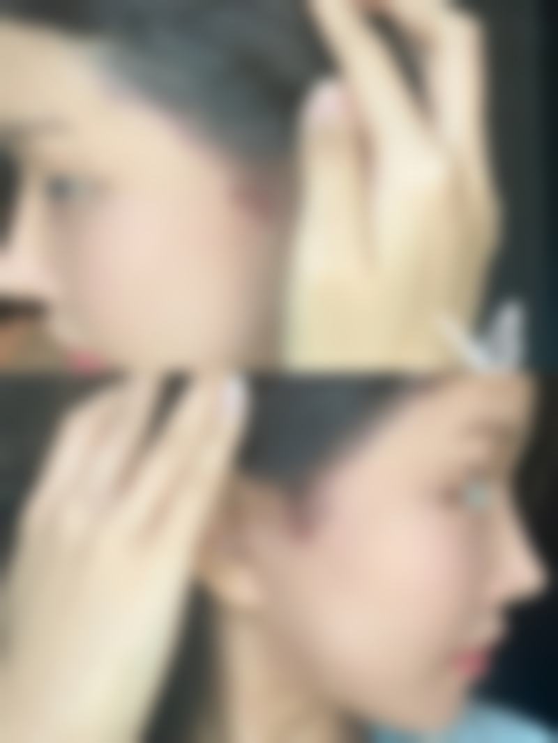 南京七度医疗美容门诊部治疗反馈与口碑评价。