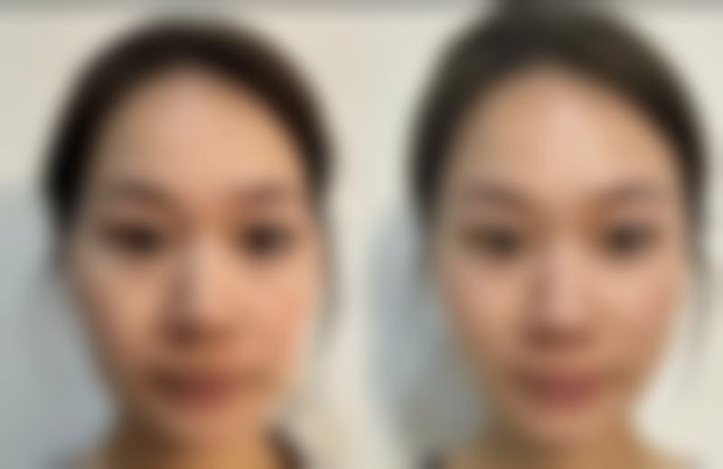 盘锦市兴隆台区联合美整形医疗美容门诊部擅长项目。