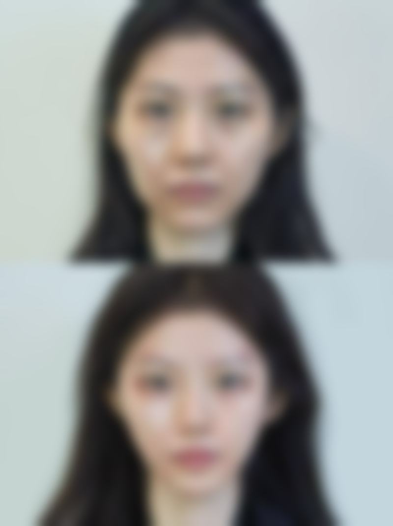 南京美米亚整形医院项目优势。