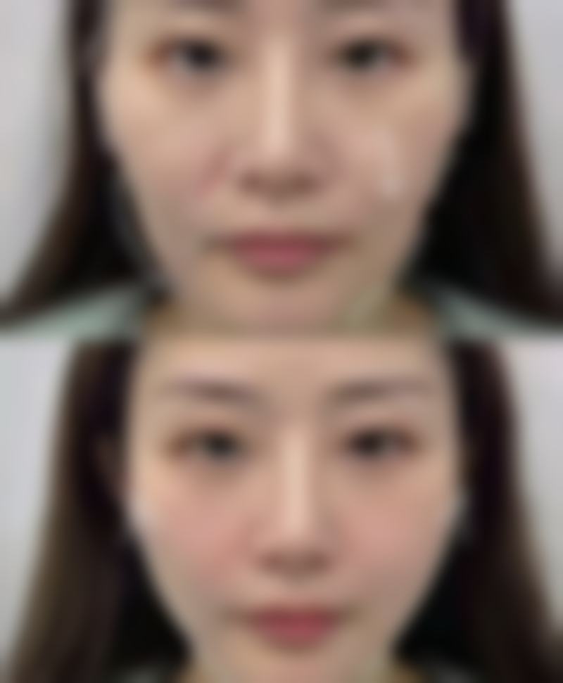 云南省邮电医院博远激光医学整形美容科擅长项目。