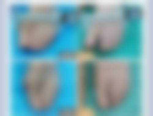 长垣樱禾原素整形医院预约挂号方式。