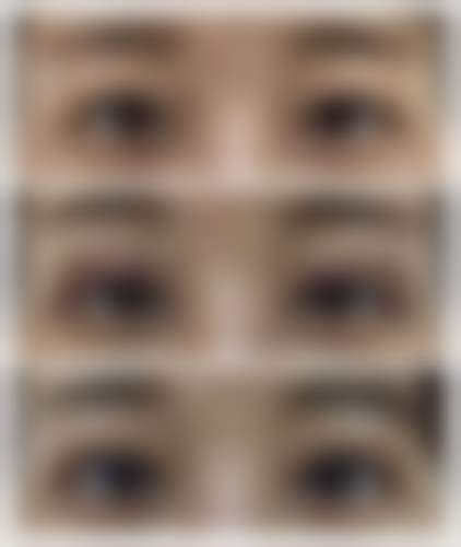 王丽珊医生技术实力