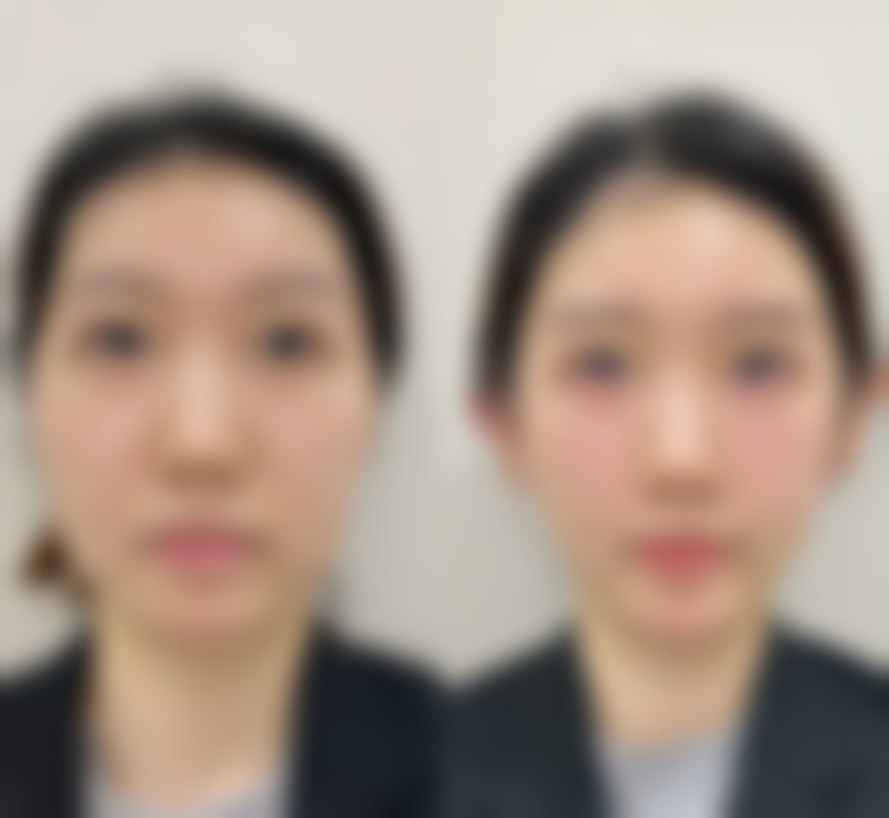 上海米瑞可国内外微整形医院预约挂号