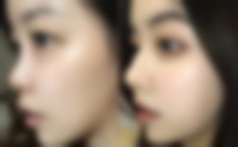 北京新面孔医疗美容门诊部擅长项目。