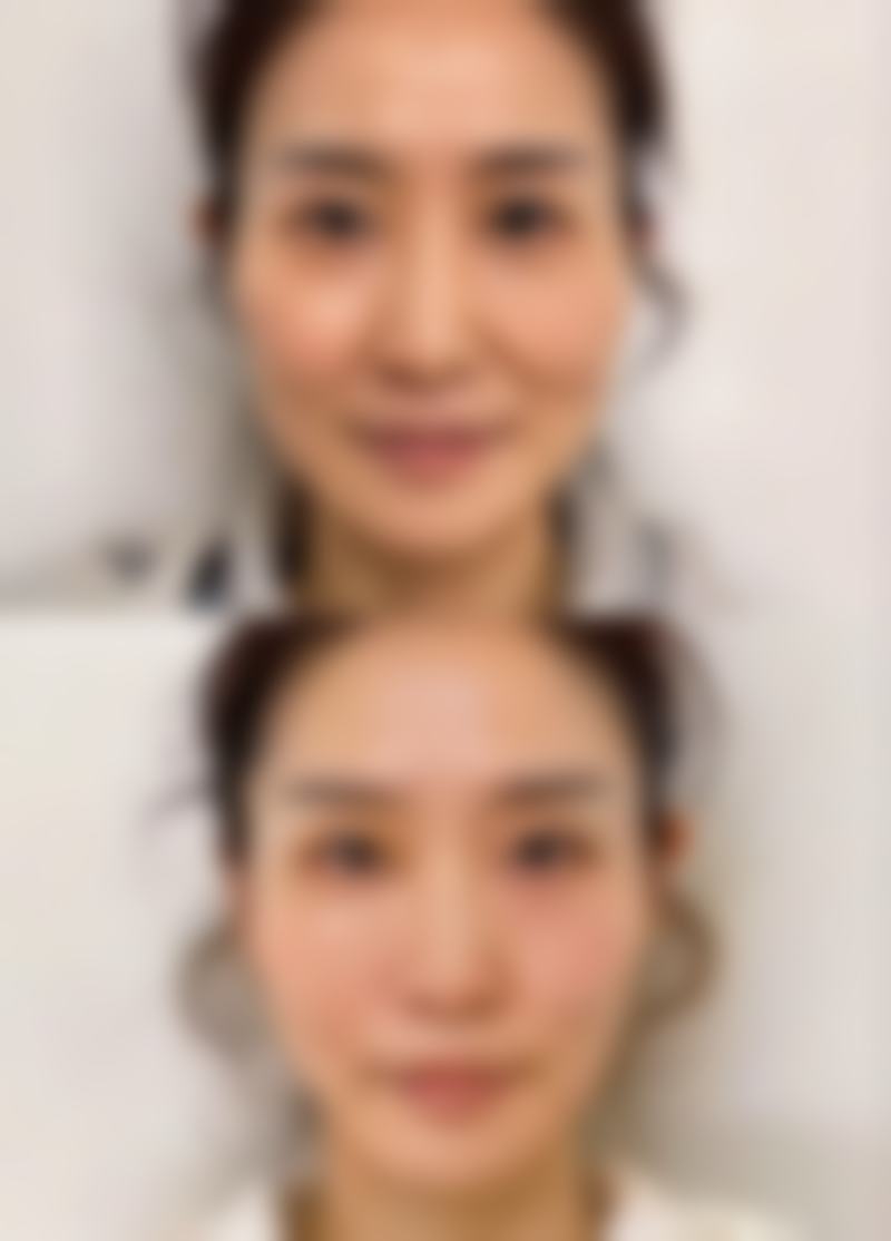天津伊妮菲尔整形医院项目优势。